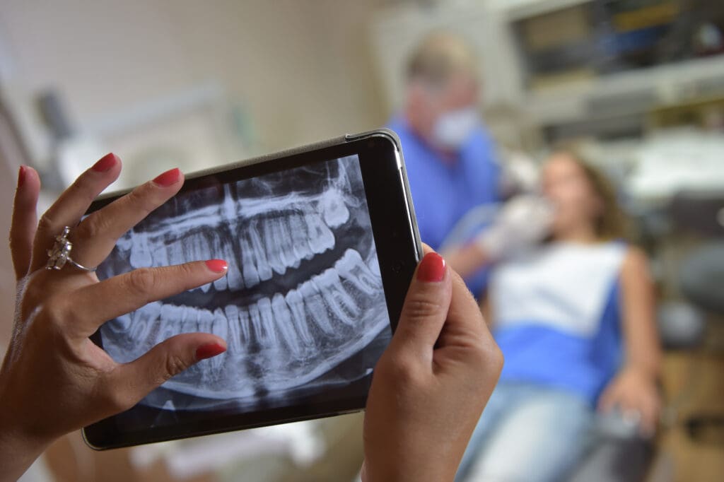 Tooth Extraction in Wilmington DE