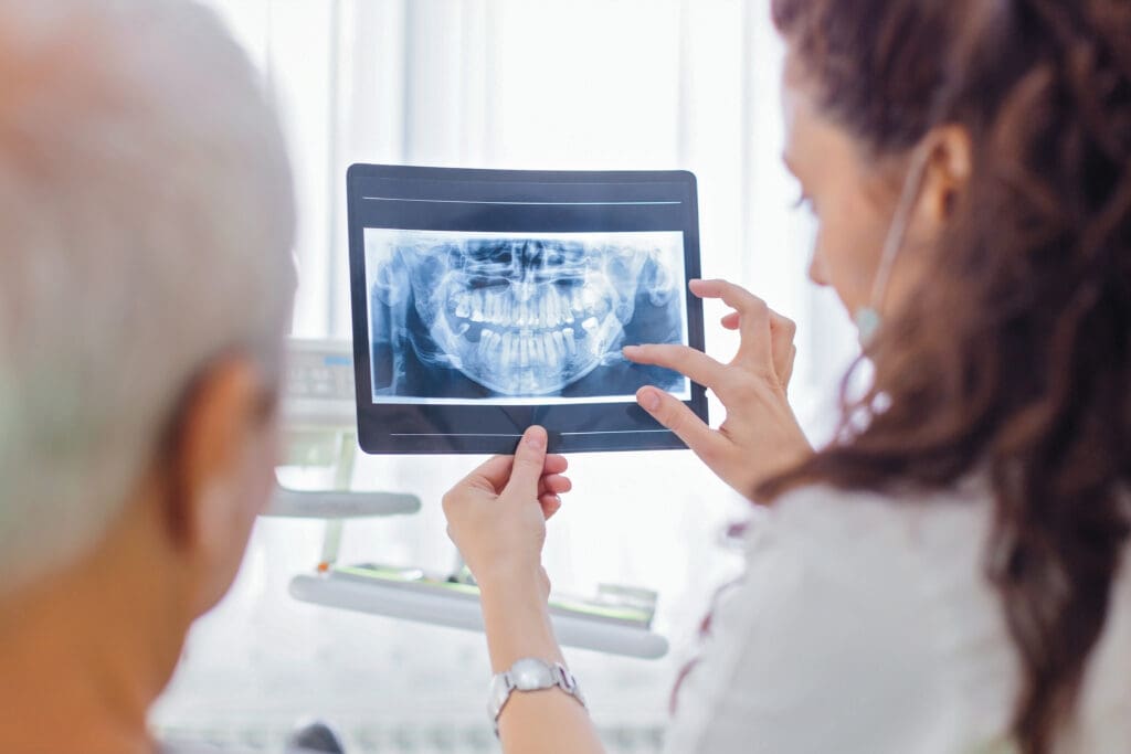 Guided Bone Regeneration in Wilmington DE Dental Office