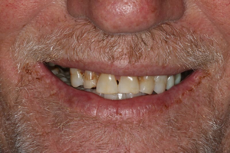 Brian Dental Before