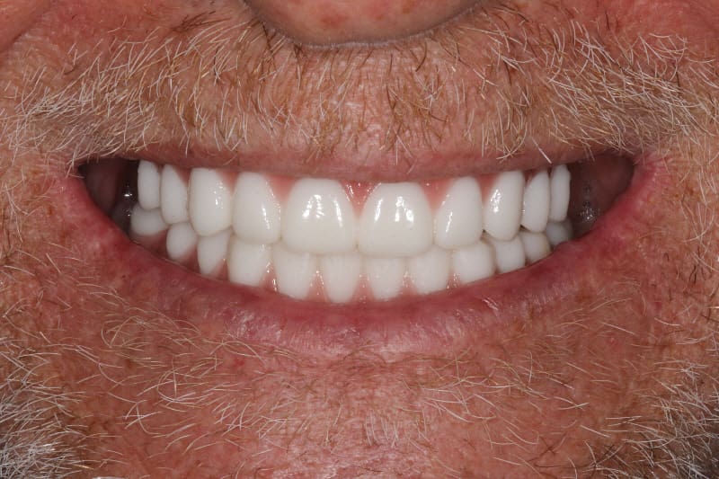 Brian Dental After