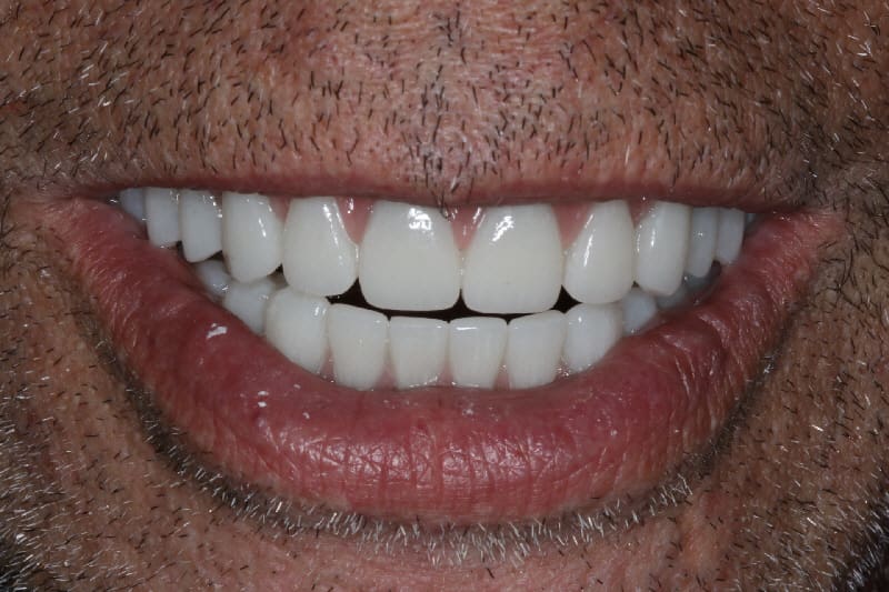 Joe Dental After